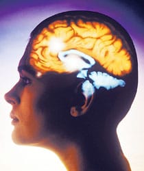 Cerebroimagen