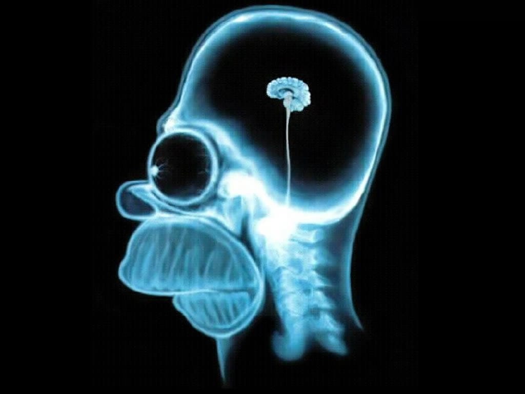 Cerebrosimpson