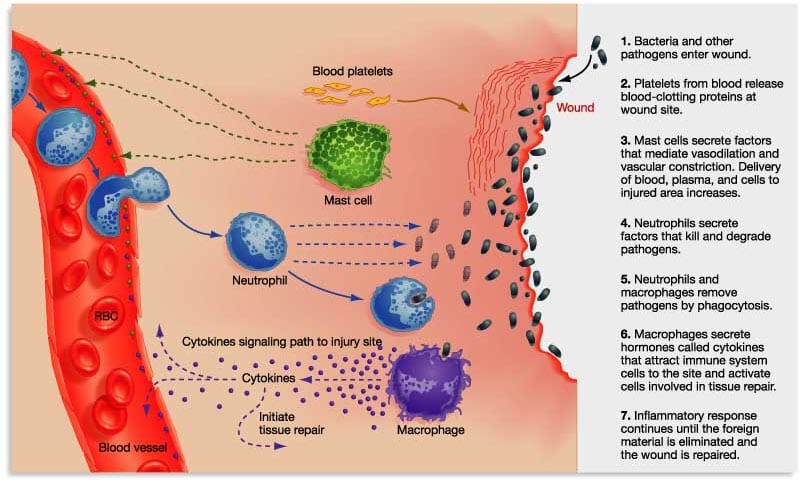 Inflamacion