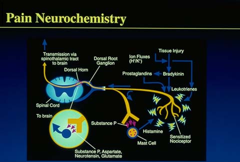 Neuronanociceptiva