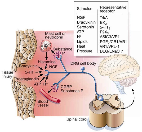 Sopainflamatoria