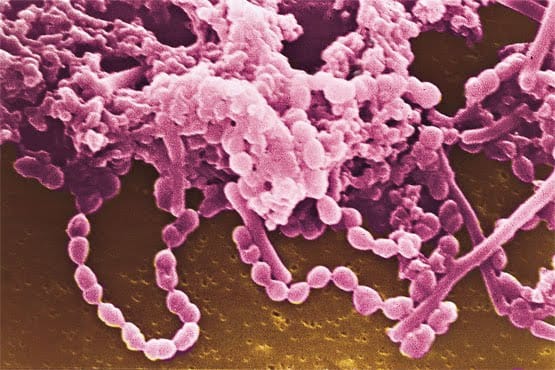 Coloniabacteria
