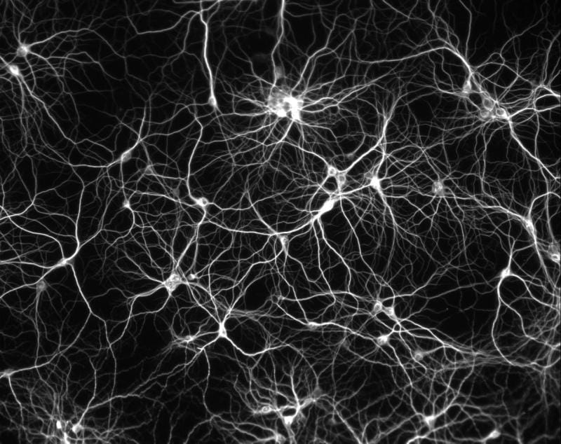 Neuron network
