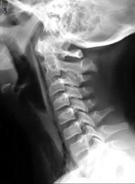 Cuello