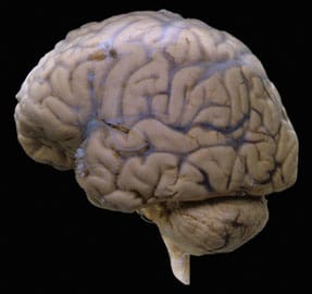 Cerebroo