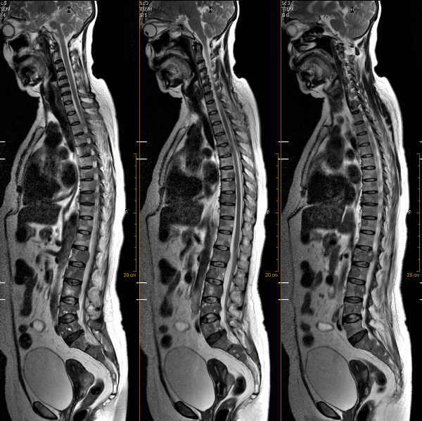 Columnatotal2