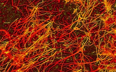 Neural network